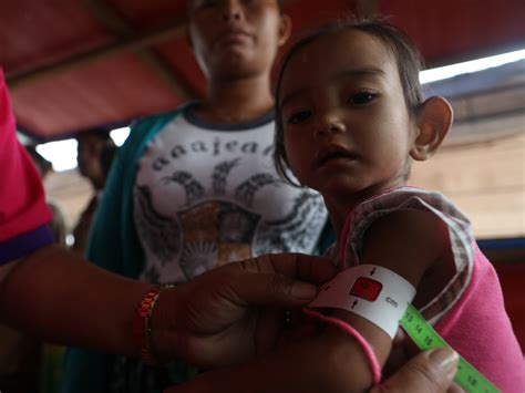 Management of SAM in the Philippines: from emergency.